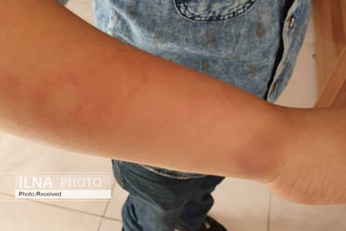 تنبیه بدنی دانش‌آموز ۱۰ ساله توسط معلم ورزش