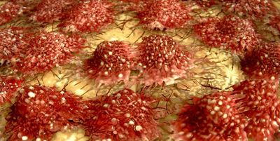 نحوه نجات سلول های ایمنی در زمان تهاجم سرطان