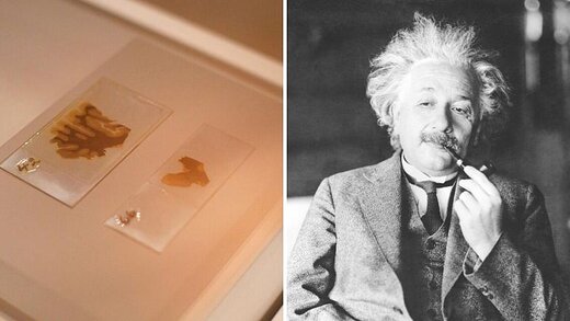 ماجرای عجیب دزدی مغز اینشتین